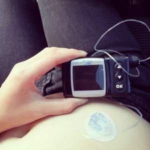 I consider myself lucky to stand a fighting chance for this piece of technology when other countries don't have access to basic diabetes treatment and care.